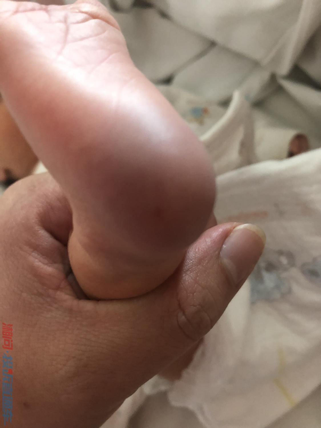 投诉红安县妇幼保健院生化科王医生