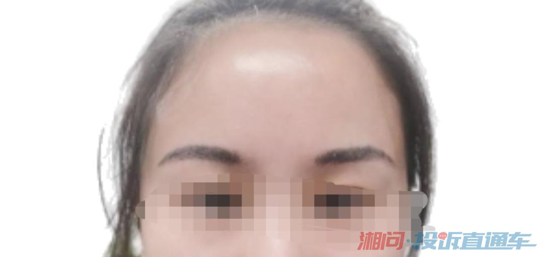 照片是我本人,眉峰位置,纹的不一样。不想去他店家去修复了,这个店家有报复心理,怕给我毁容