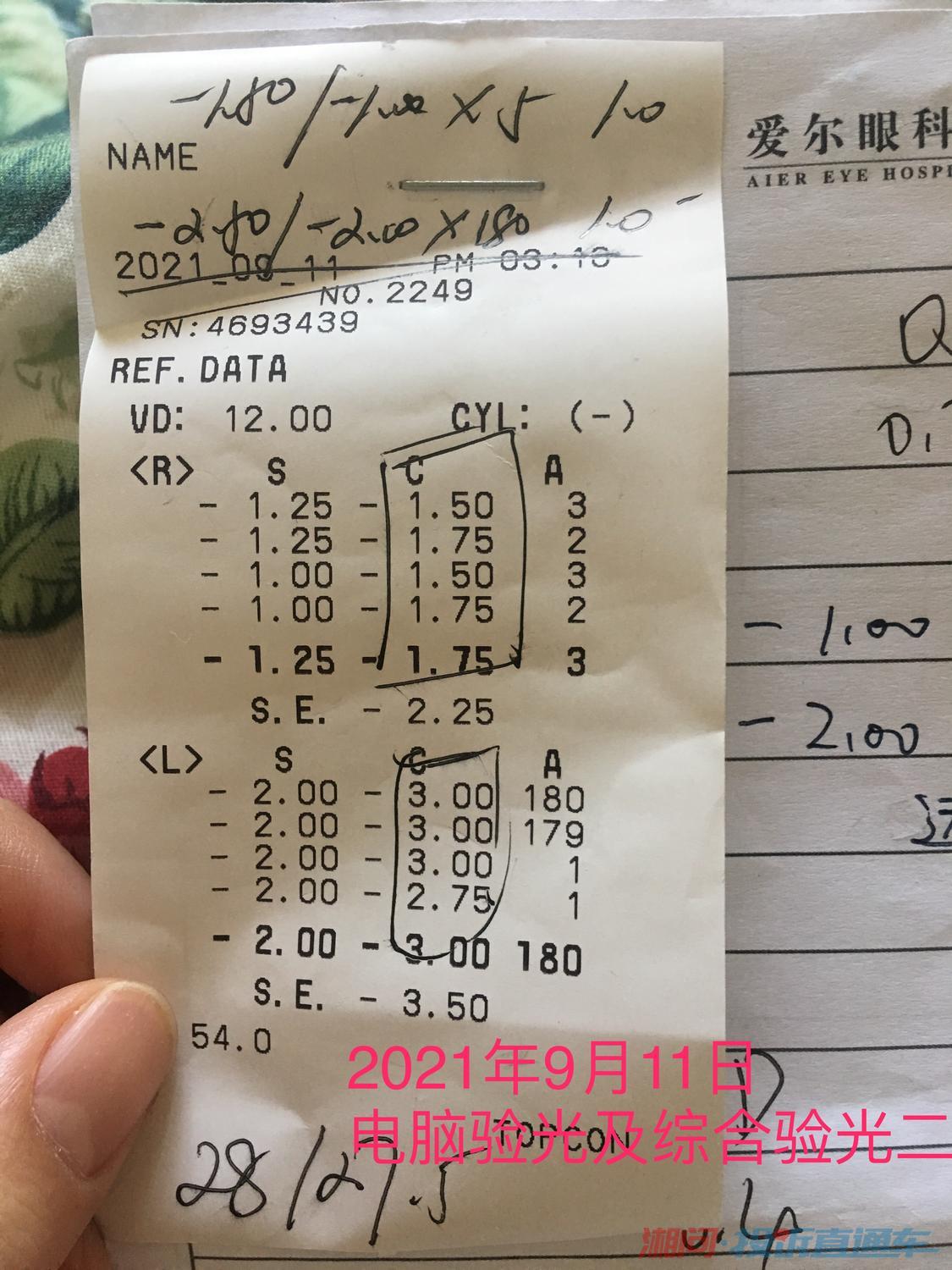 配眼镜严重欠矫,孩子长期佩戴看清的眼睛导致视力非正常大幅度下滑