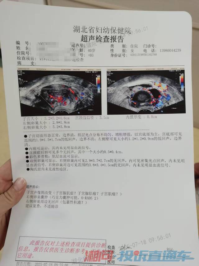 什么时候检查卵泡 681ddb3ec60dc121ed3bd374b7aaa665.jpg